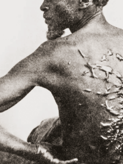 Historical photo of a formerly enslaved man whose back is covered in scars from being whipped.