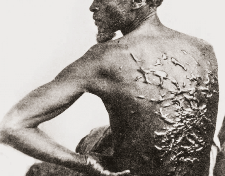 Historical photo of a formerly enslaved man whose back is covered in scars from being whipped.