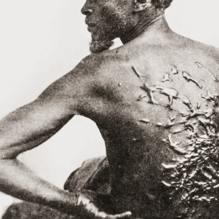 Historical photo of a formerly enslaved man whose back is covered in scars from being whipped.